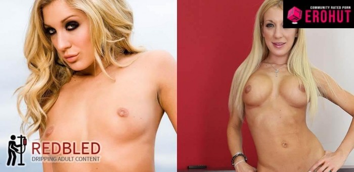 amy-brooke-before-after-breast-implants.jpg