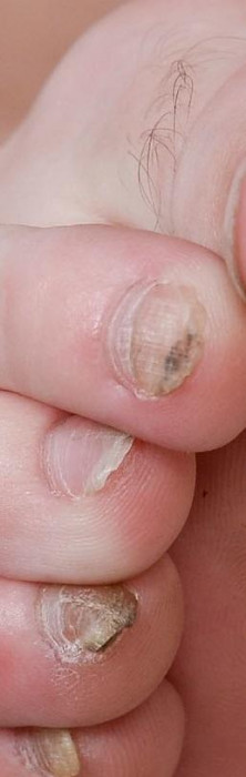 anna de ville hairy toes dirty nails.jpg
