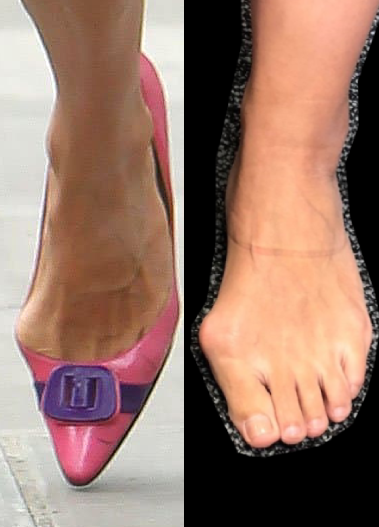 bunion narrow toe box.png