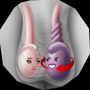 testicles twisted.png