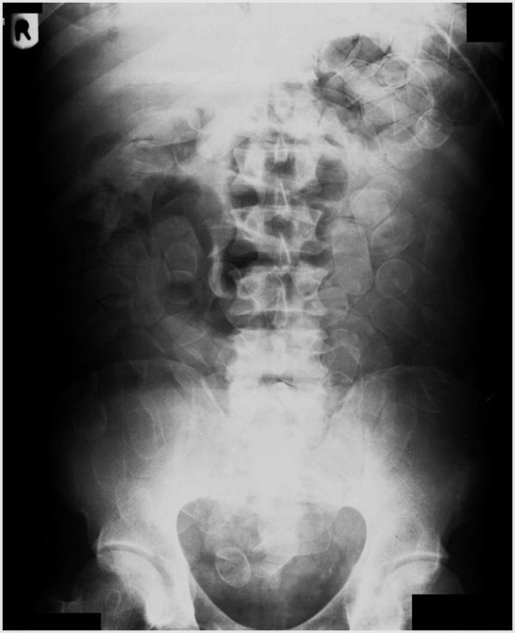 X-Ray.jpg (40.33 KiB) Viewed 827 times X-Ray.jpg